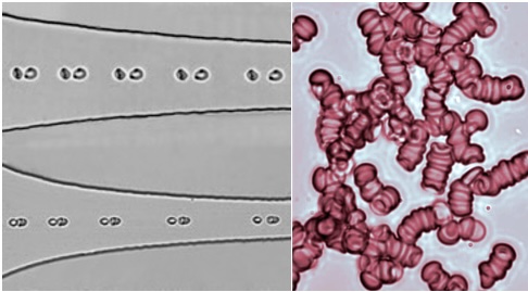 Déformabilité et aggrégation des globules rouges